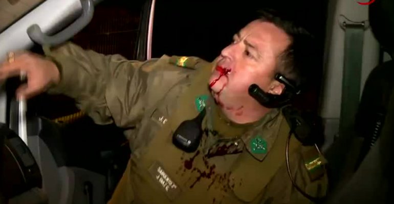 Carabinero fue herido por piedrazo después de protagonizar persecución policial - Parte 2