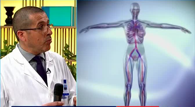 Conoce cómo evitar la aparición de várices en el cuerpo
