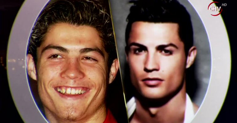 Las transformaciones más drásticas de las grandes celebridades