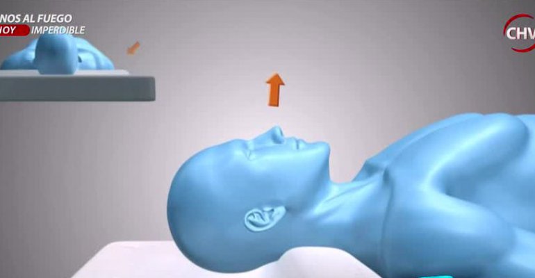 Neurólogo explica los trastornos del sueño y las razones de los ronquidos - Parte 3