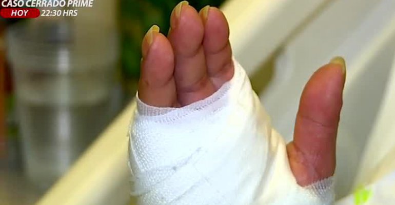 Mujer denuncia que tras sufrir esguince le amputaron un dedo por negligencia médica