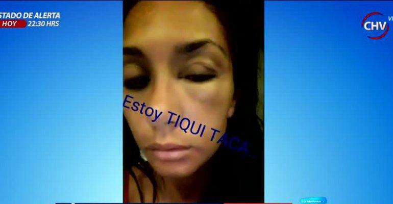 Pamela Díaz reveló la razón de su extraña hinchazón en el ojo