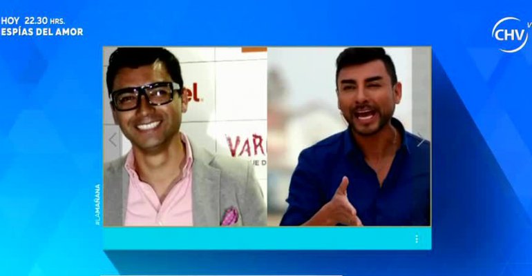 Conoce a los famosos que utilizan botox en nuestra TV