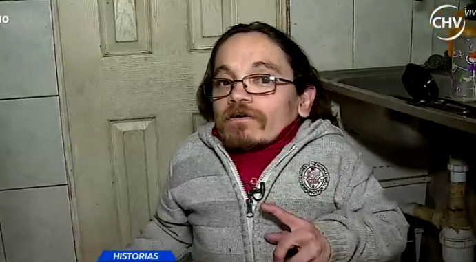Actor nacional vive con extraño síndrome de Morquio - Parte 1