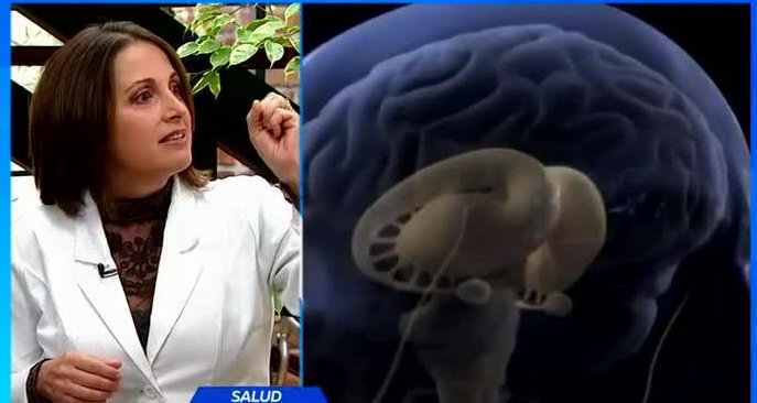 Aprende a distinguir los distintos tipos de dolor de cabeza