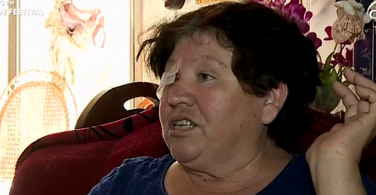 Mujer fue herida en ritual evangélico y podría perder visión