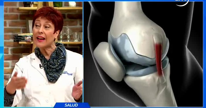 Aprende a evitar el dolor de huesos provocado el frío - Parte 1