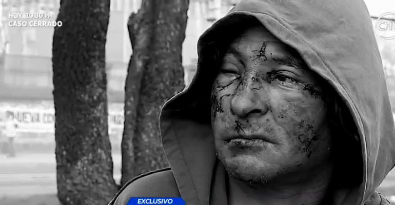 El testimonio del hombre que le intentaron sacar los ojos