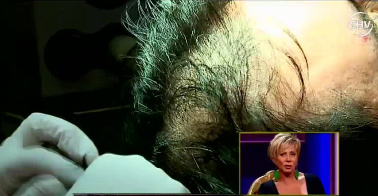 Los famosos y sus cirugías plásticas ocultas