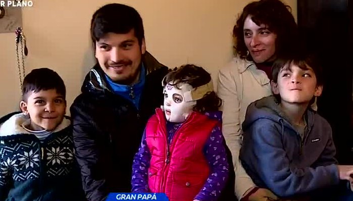 Papá dejó de trabajar para cuidar a su familia que se quemó - Parte 1
