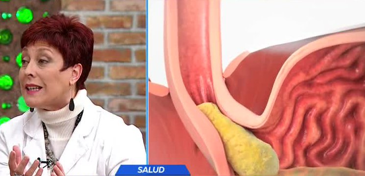 Experta explicó los secretos que oculta la acidez