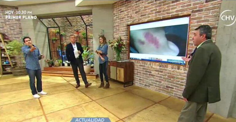 Joven murió por chupón en el cuello que le hizo su novia