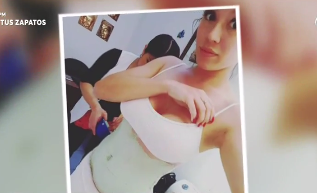 Famosas ocupan nuevas técnicas estéticas para el verano