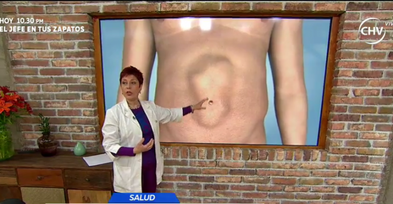 Aprenda a detectar cuándo una hernia es peligrosa