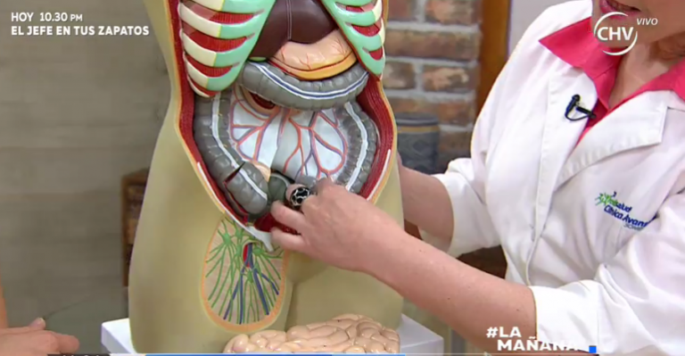 ¿Colon irritable podría provocar cáncer?