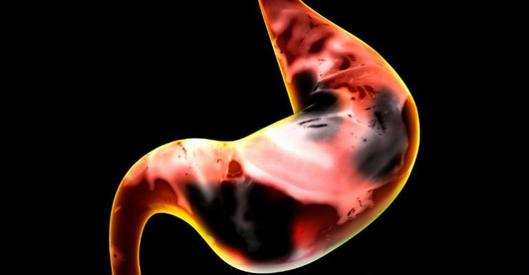Cáncer de Estómago - Vidas en Riesgo
