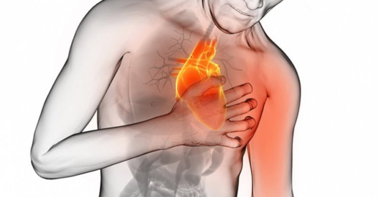 Infarto agudo al miocardio - Vidas en Riesgo