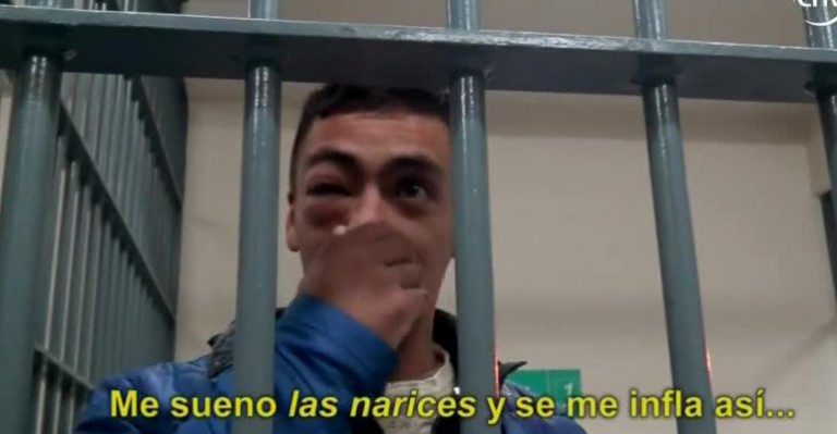 Recluso trató de ocultar la verdad sobre golpe que recibió en un ojo