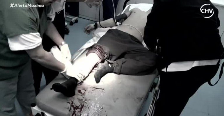 Reo resultó herido en la pierna con estoque tras riña