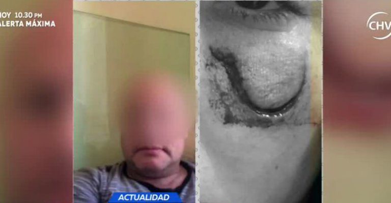 Mujer agredida por su pareja con una bicicleta dio su verdad - Parte 2