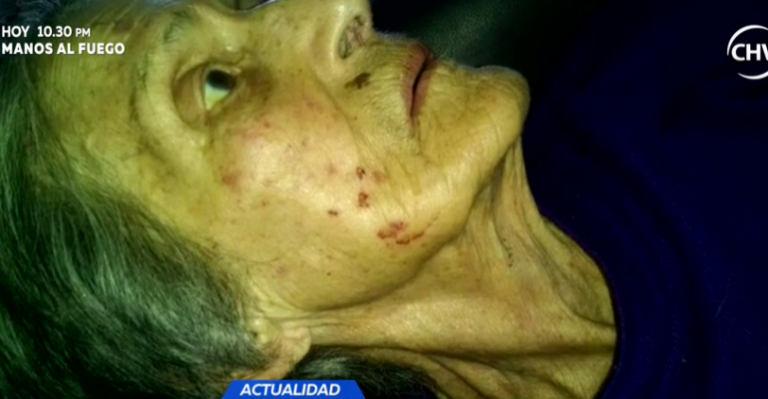 Denuncian maltrato a abuelita por parte de su hija