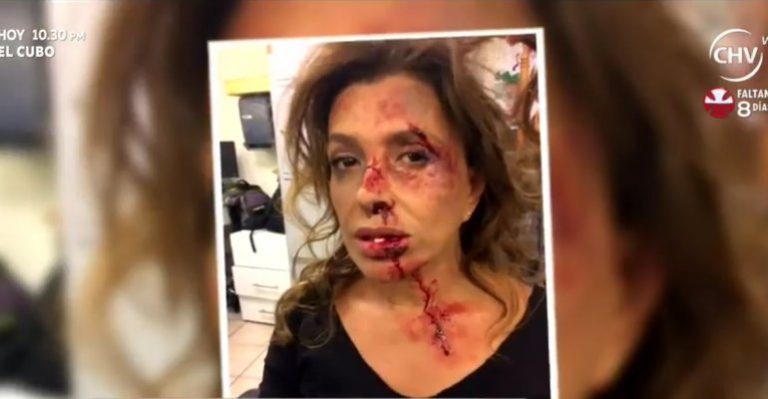 Carolina Arreguí en impactante campaña contra la violencia