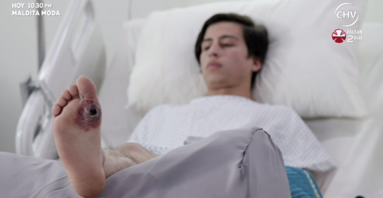 Rubén fue picado por una araña de rincón y estuvo al borde de la muerte - Parte 2