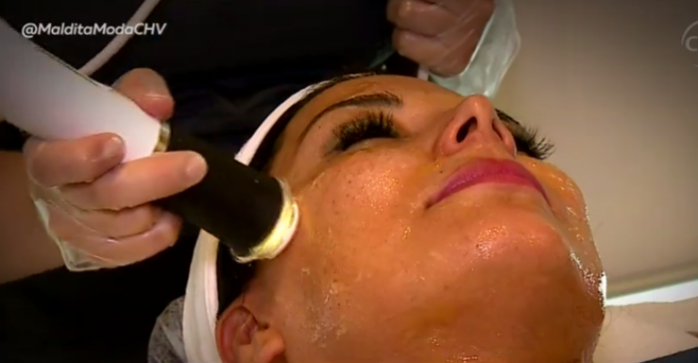 Estos son los tratamientos estéticos de los famosos