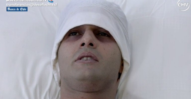 Una fractura en la mano de Felipe escondía un enemigo silencioso - Parte 3