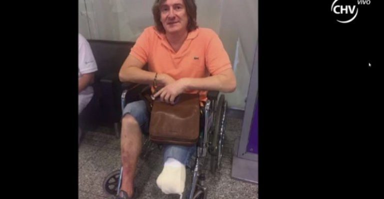 Ex arquero Nicolás Villamil sufrió amputación en una pierna
