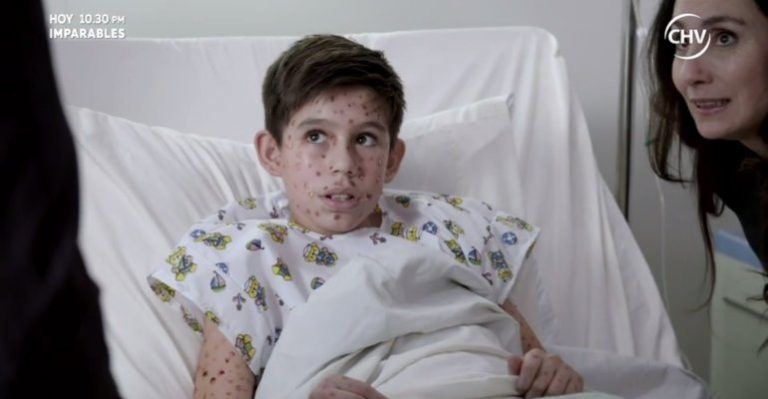 La varicela puede ser mucho más grave que simple picazón - Parte 4