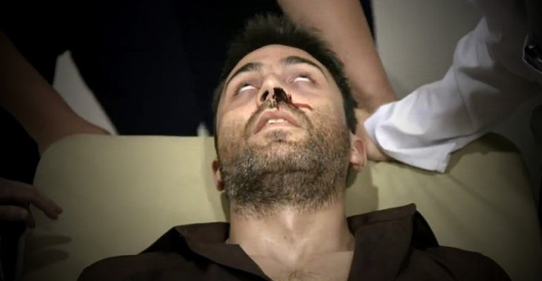 El consumo de cocaína me trajo problemas cardíacos severos - Parte 2