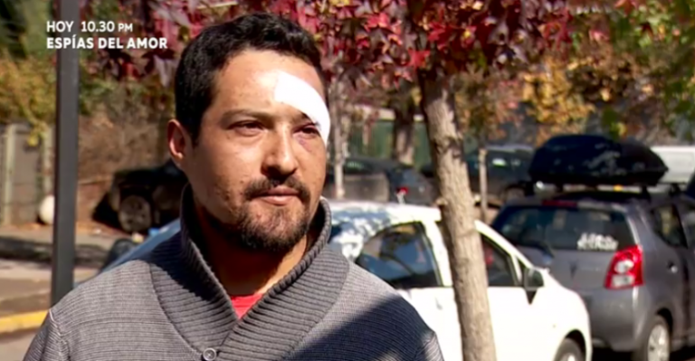 Pasajero le mordió la cara a chofer de Transantiago