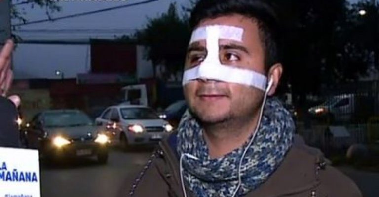 Víctima de accidente busca a chofer que lo atropelló