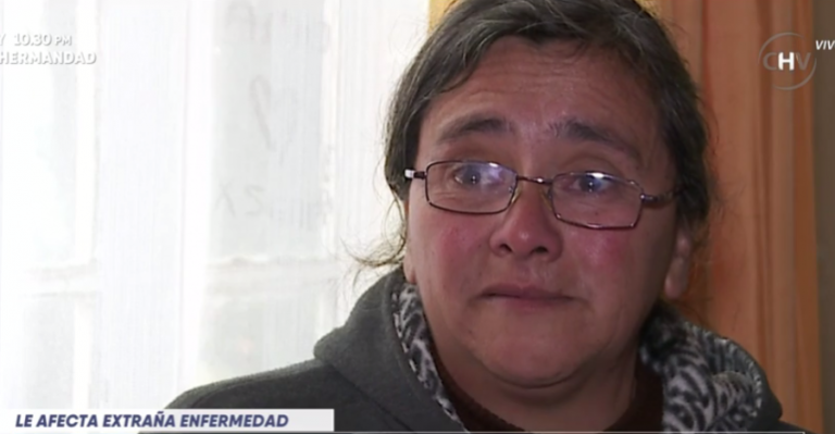 Mujer sufre enfermedad que la dejará con la mente en blanco