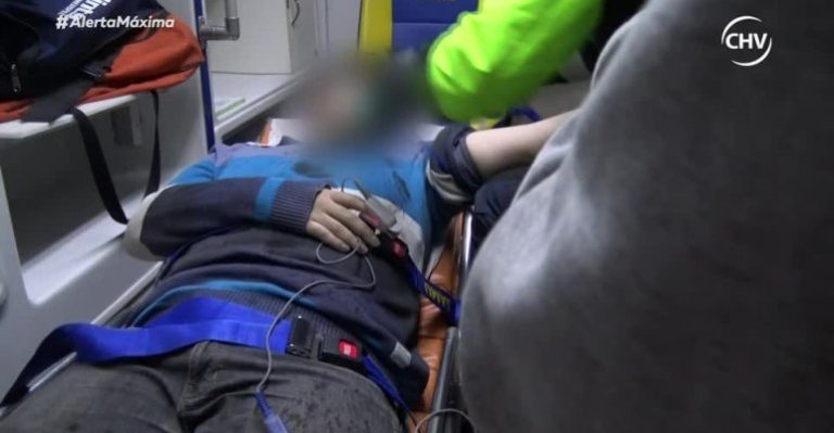 Joven recibió una brutal golpiza en Parque Forestal por su condición sexual