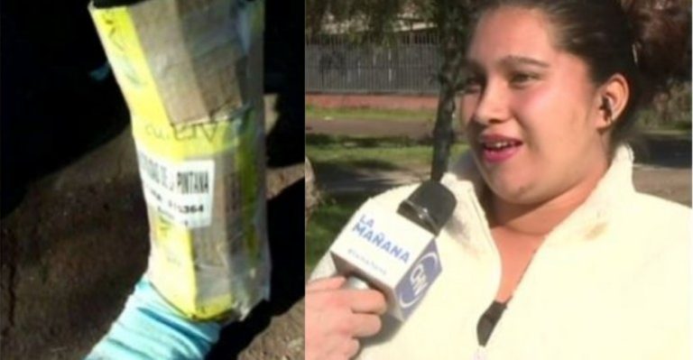 Joven habló de su insólito tratamiento de Yeso de Cartón