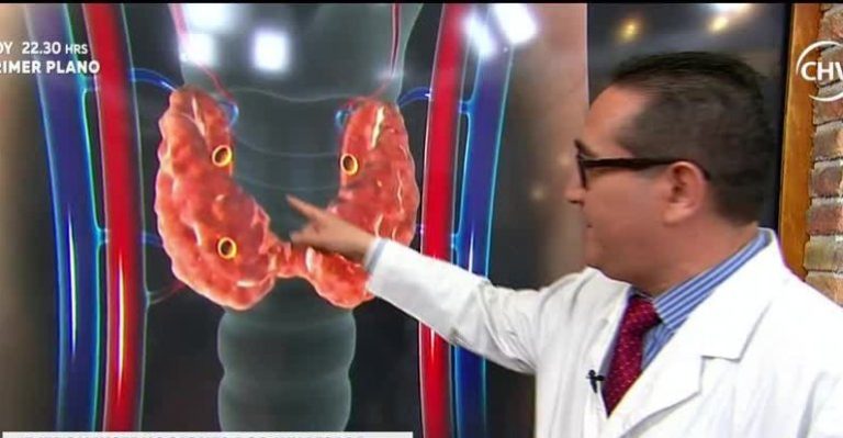Dr. Ortíz explicó cómo detectar problemas a la tiroides - Parte 2