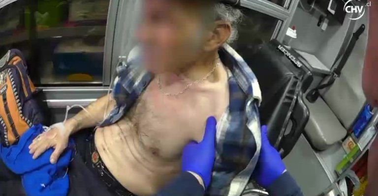 Adulto mayor sufrió luxación en su hombro tras caída en la vía pública