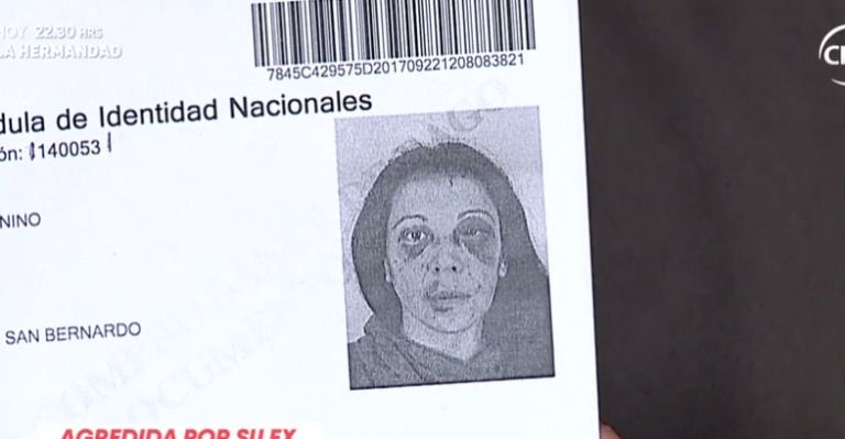 Mujer que aparece golpeada en su carnet habló con La Mañana