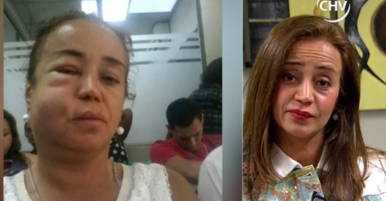 Periodista fue víctima de asalto y recibió brutal golpiza