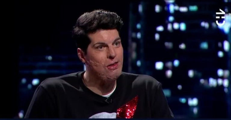 El antes y después del accidente de Ignacio Lastra