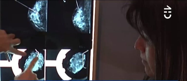 Urgente llamado a chilenas para realizarse autoexamen e identificar la presencia de cáncer de mama en forma oportuna