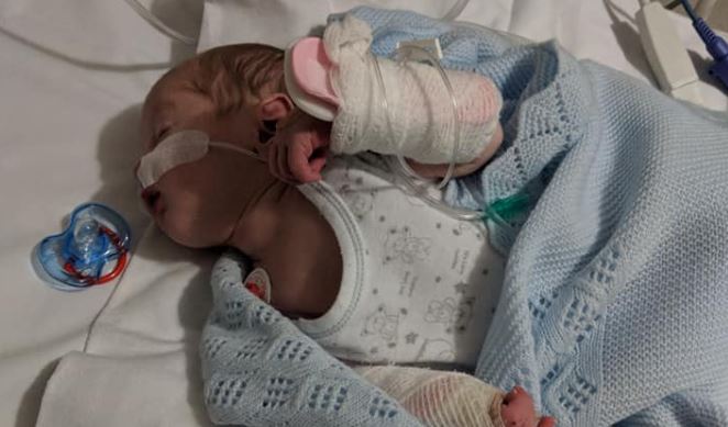 Guagua de 11 días de vida contrajo grave enfermedad luego de ser besado en la boca