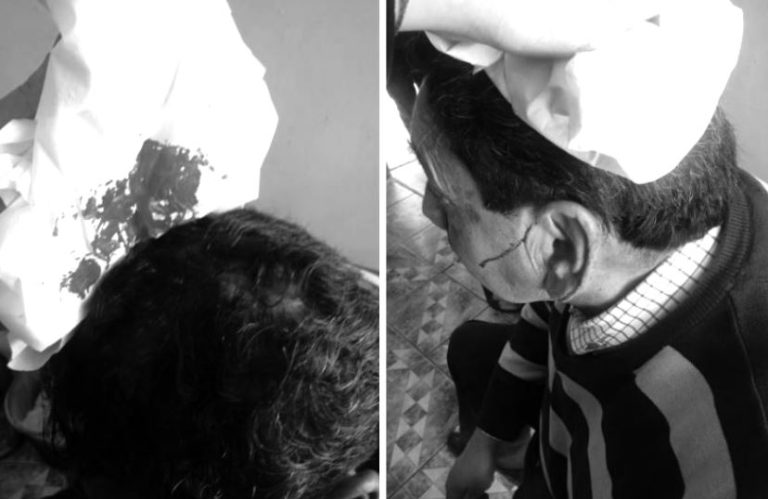 “Me tiró un combo y le hice el quite”: Profesor denuncia brutal ataque de un apoderado en su contra