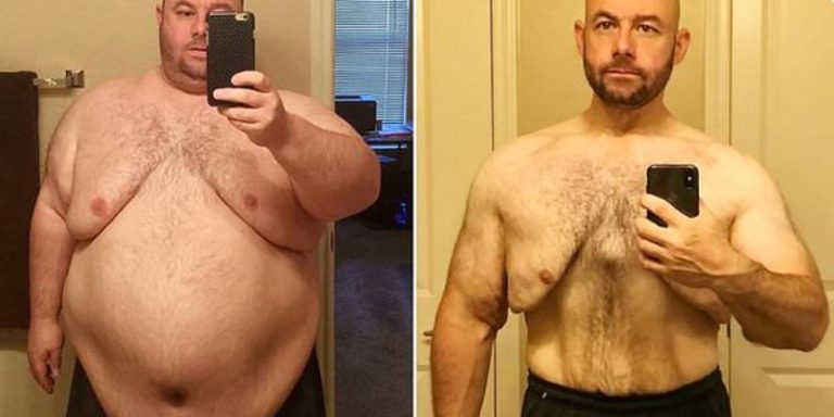 Bajó más de 101 kilos después que su polola lo dejó por estar demasiado gordo para tener sexo