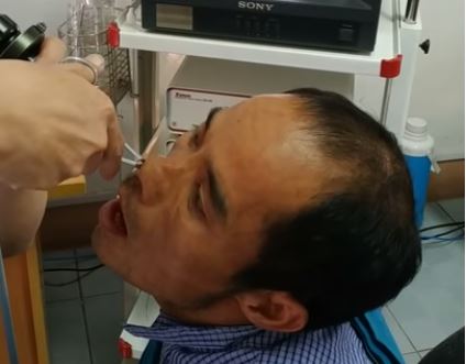 Video muestra el momento exacto en que un médico sacó un animal vivo de la nariz de su paciente