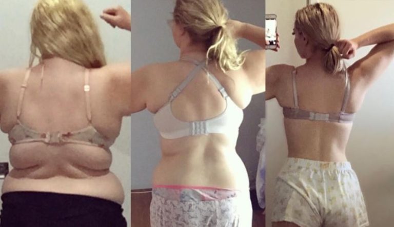 “No más la gorda Josie”: El increíble cambio de joven que bajó 63 kilos por el bullying que recibía en su colegio