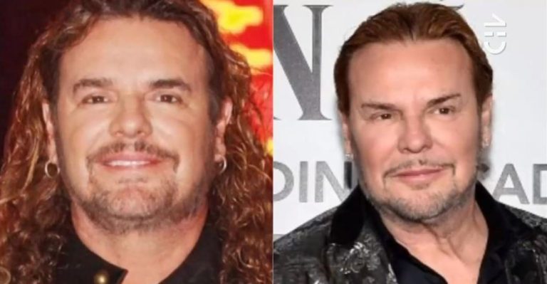 Encuentre las 5 diferencias: Burlas y criticas generó la cirugía facial que lució el cantante de Maná en los Grammy