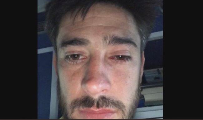 Copa Libertadores: Así quedaron los jugadores de Boca que fueron agredidos